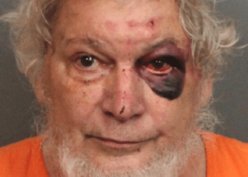 Booking photo of Alabama church shooting suspect shows he got walloped by ‘hero’ taking him down – Law Officer