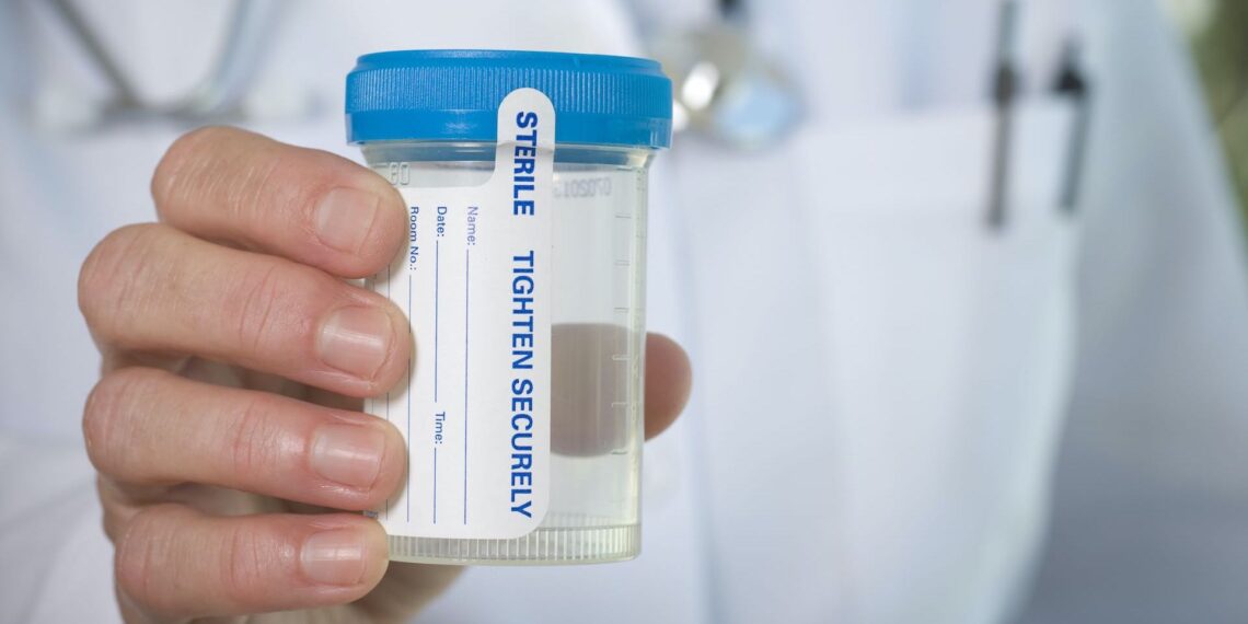 NYPD backpedals on decision to end marijuana testing for officers