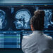 doctor looking atbrain injury scans