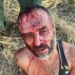 Wounded migrant