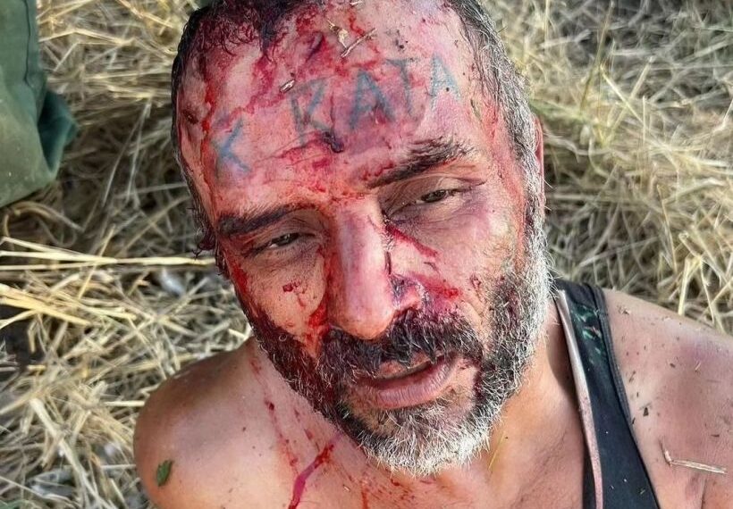 Wounded migrant