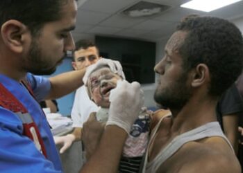A wounded infant receives treatment at Al-Shifa Hospital.