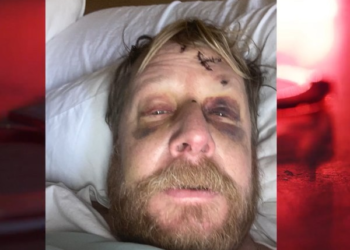 Ala. deputy who was beaten, injured by suspect fears for colleagues’ safety amid staff shortages