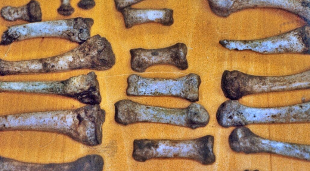 Here's How YOU Can Identify the Bones Found in Your Backyard