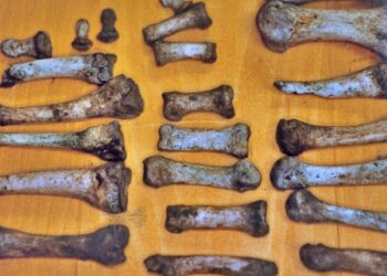 Here's How YOU Can Identify the Bones Found in Your Backyard